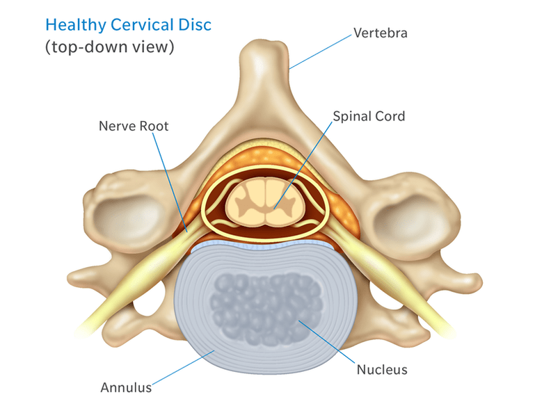La estructura del disco intervertebral
