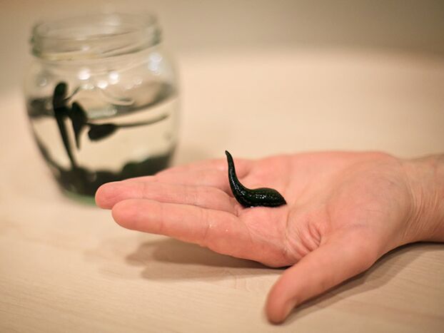 Aplicación para el tratamiento de la artrosis de la articulación de la rodilla.