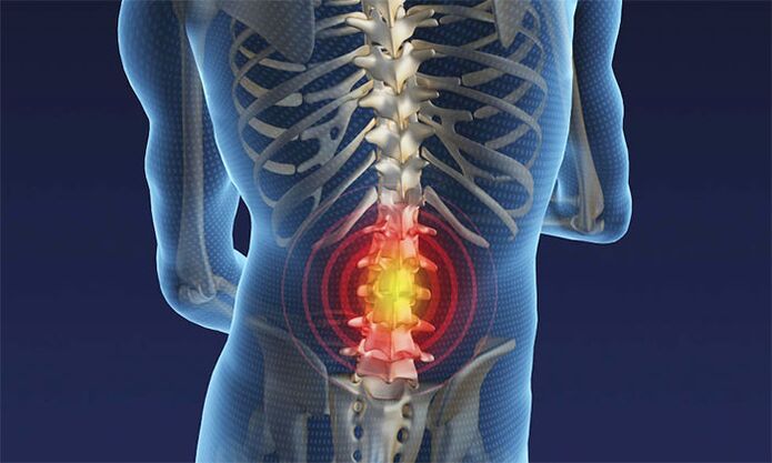 dolor en la región lumbar