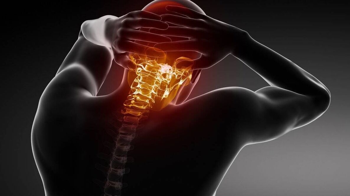 síntomas de osteocondrosis cervical